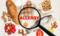 meredakan alergi makanan